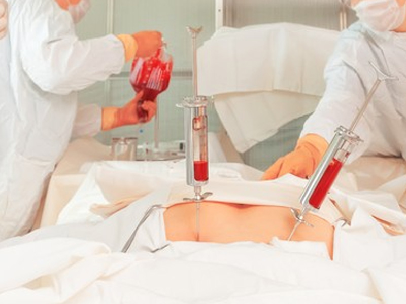 Cancer Treatment in Chembur